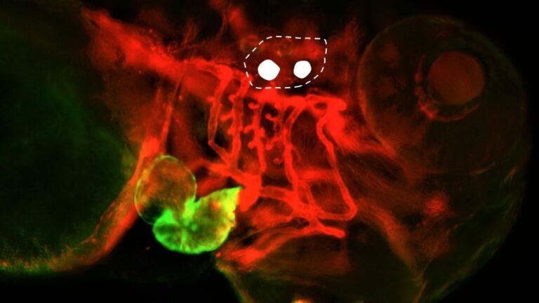 Optogenetica