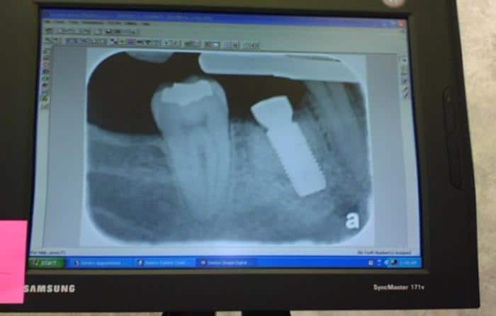 Dentista robot