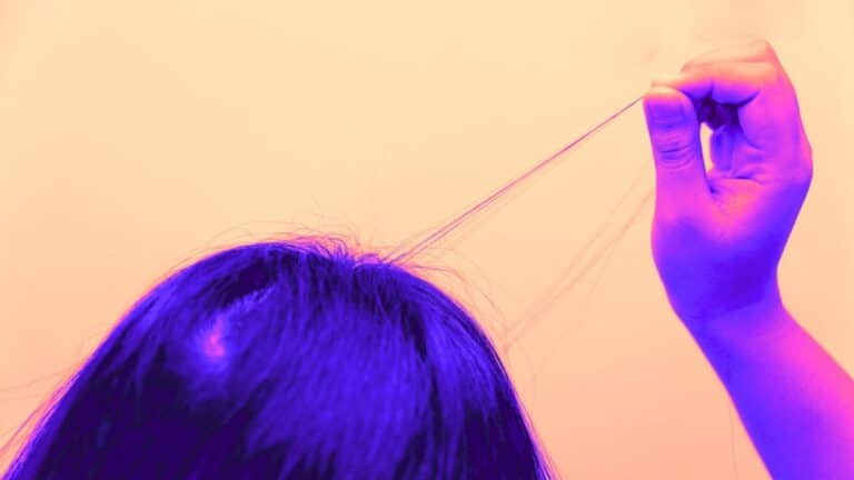 Tricotillomania