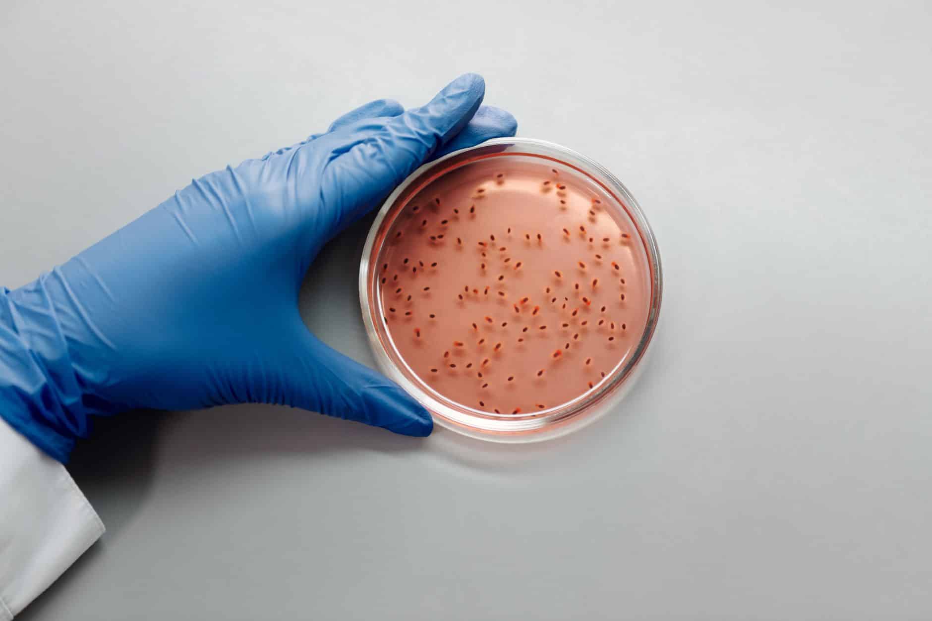 Una mano con guanto blu tiene una capsula di Petri con colonie batteriche su terreno rosato. Cancro al colon