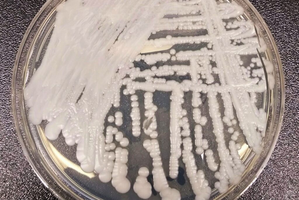 Candida Auris continua a respingere qualsiasi farmaco gli mettiamo contro