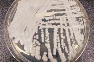 Candida Auris continua a respingere qualsiasi farmaco gli mettiamo contro