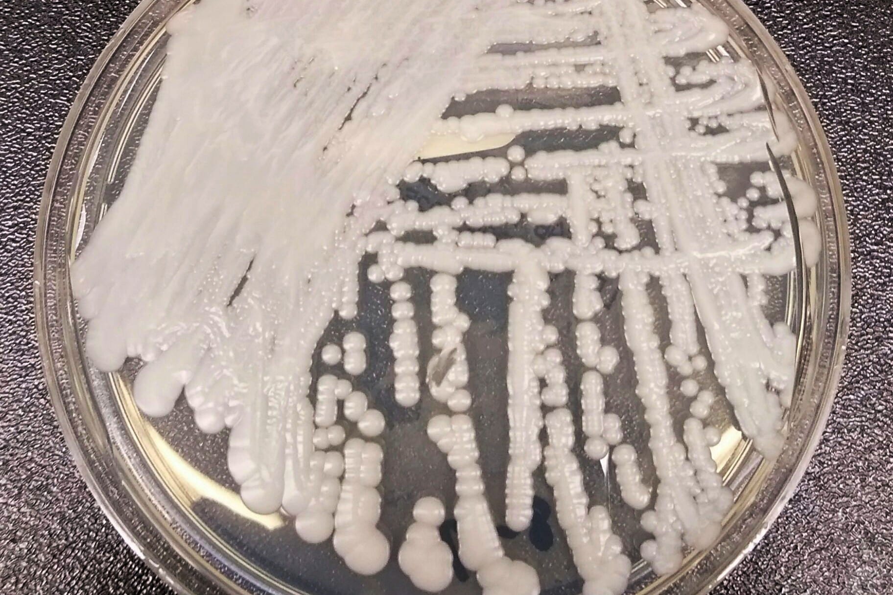 Candida Auris continua a respingere qualsiasi farmaco gli mettiamo contro