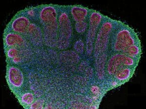 Organoidi cerebrali umani hanno imparato a riconoscere le lettere Braille
