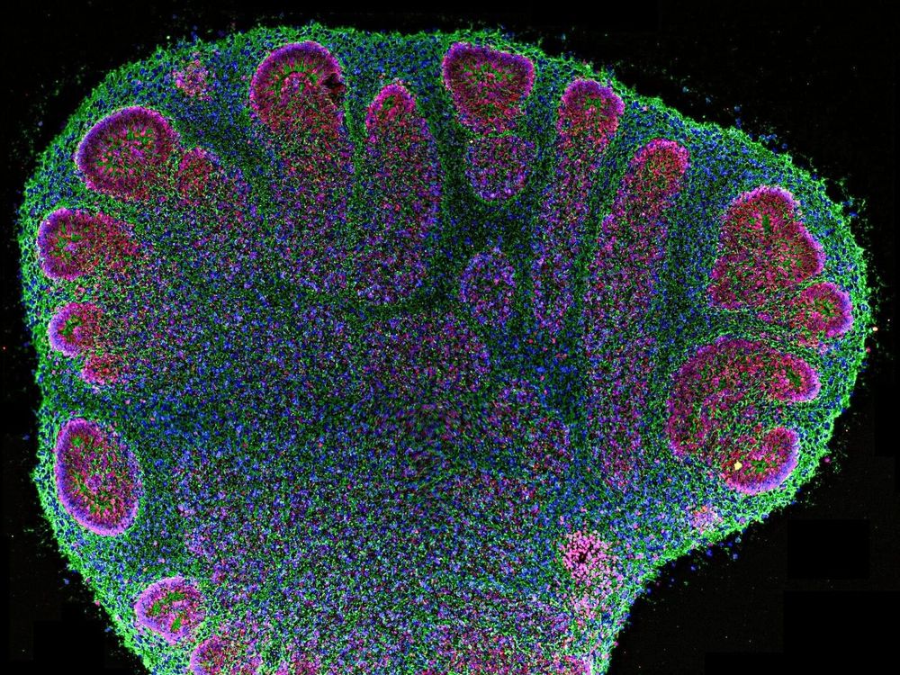 Organoidi cerebrali umani hanno imparato a riconoscere le lettere Braille