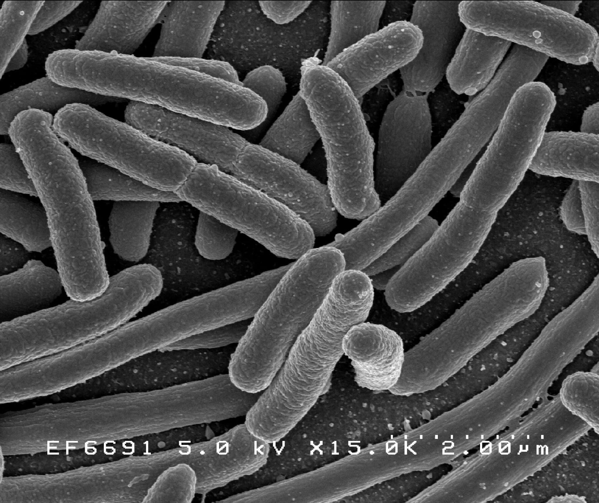 Escherichia coli al microscopio elettronico, il batterio che il tessuto autodisinfettante ha inattivato in laboratorio