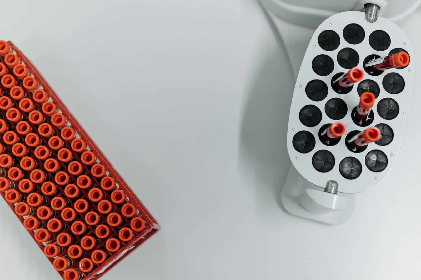 Provette di sangue in una centrifuga da laboratorio, termine di paragone per il chip a manovella che legge il gruppo sanguigno