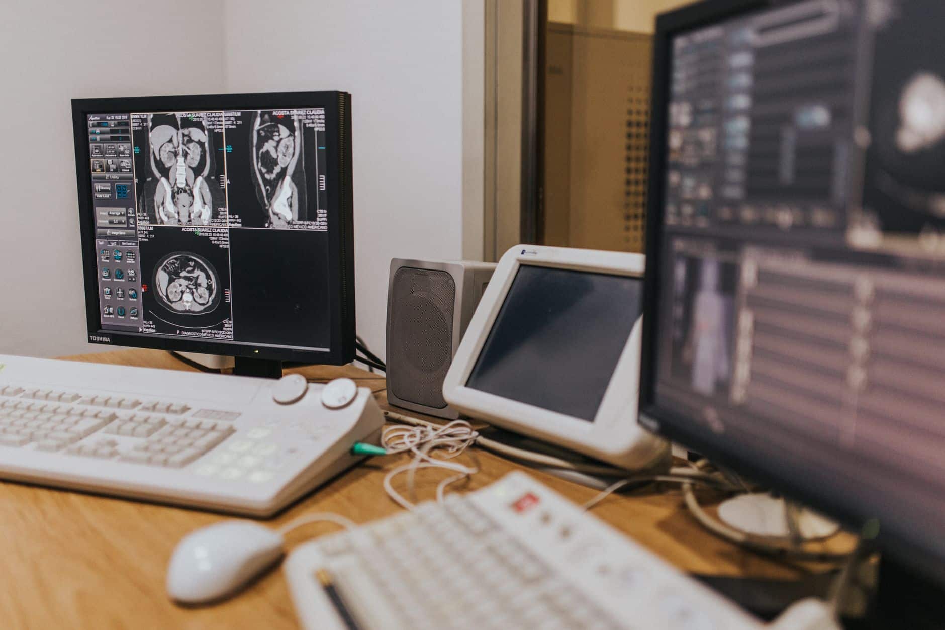 Schermi con immagini di risonanza magnetica in un reparto di radiologia, usate per controllare la risposta all'immunoterapia nel cancro del retto