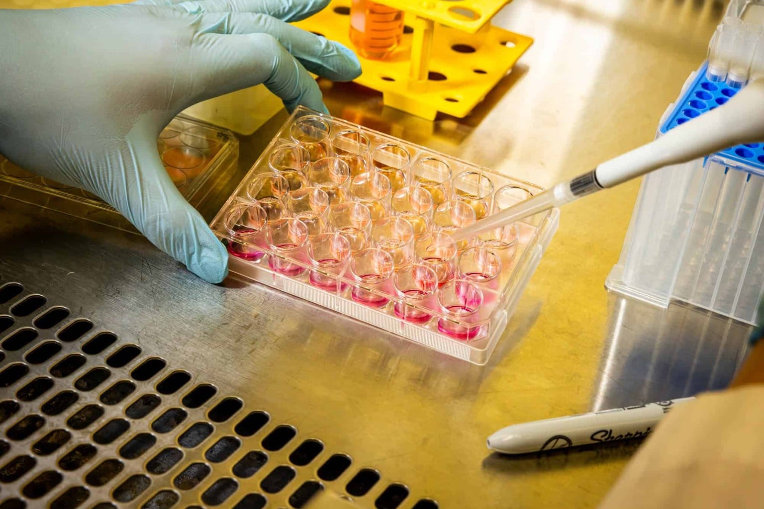 Mano guantata che usa una pipetta su una piastra di coltura cellulare, lavoro di laboratorio sulle infezioni e sui tumori