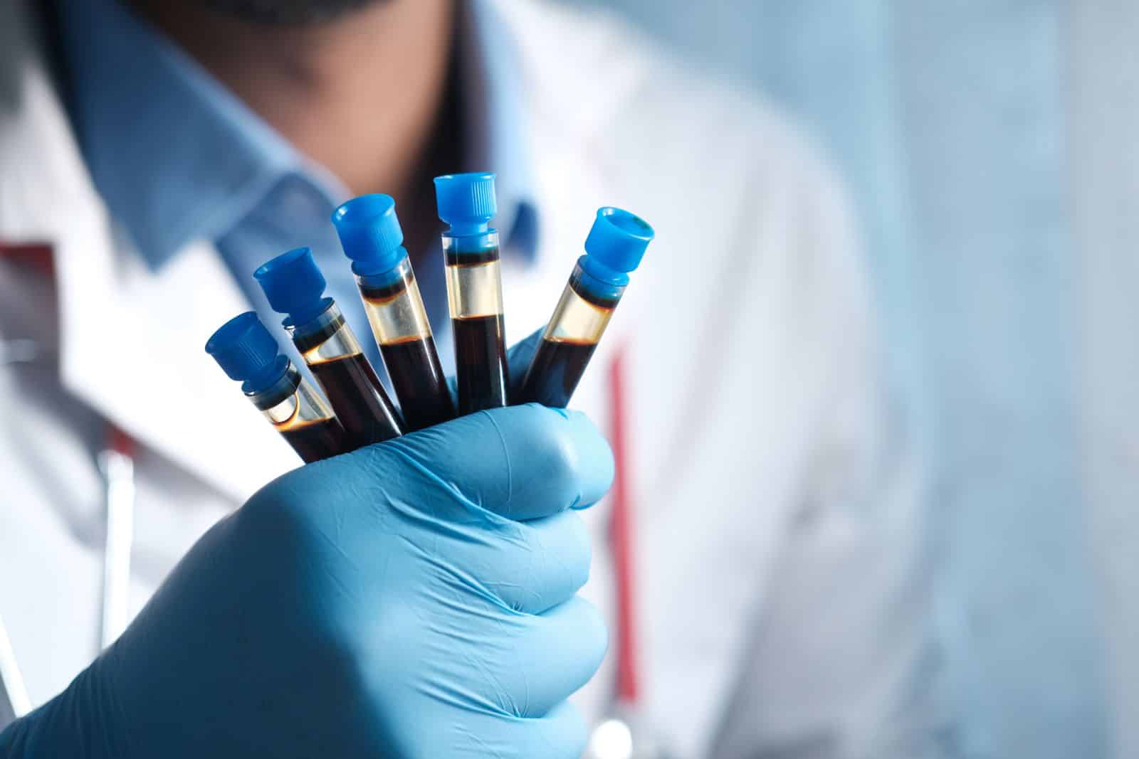 Tecnico di laboratorio con provette di sangue, il materiale da cui si misura l'età biologica negli studi su dieta e invecchiamento