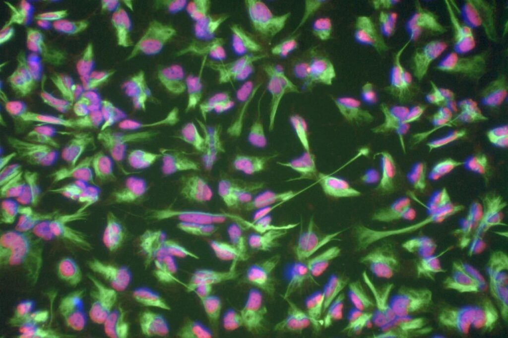 Cellule staminali neurali al microscopio a fluorescenza, con nuclei rosa e filamenti verdi, ottenute da sangue di un donatore di 101 anni. Ringiovanimento