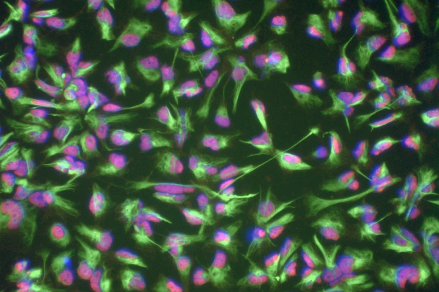 Cellule staminali neurali al microscopio a fluorescenza, con nuclei rosa e filamenti verdi, ottenute da sangue di un donatore di 101 anni. Ringiovanimento