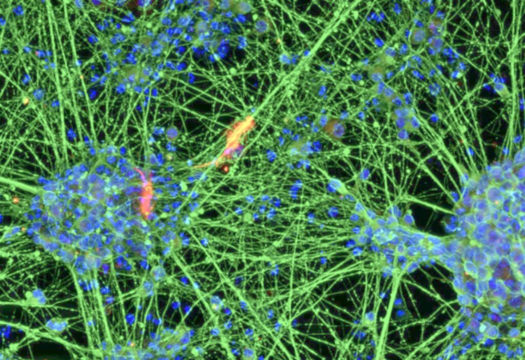 Fitta rete di neuroni al microscopio, con fibre verdi e nuclei blu, nati da staminali neurali ricavate dal sangue. Ringiovanimento