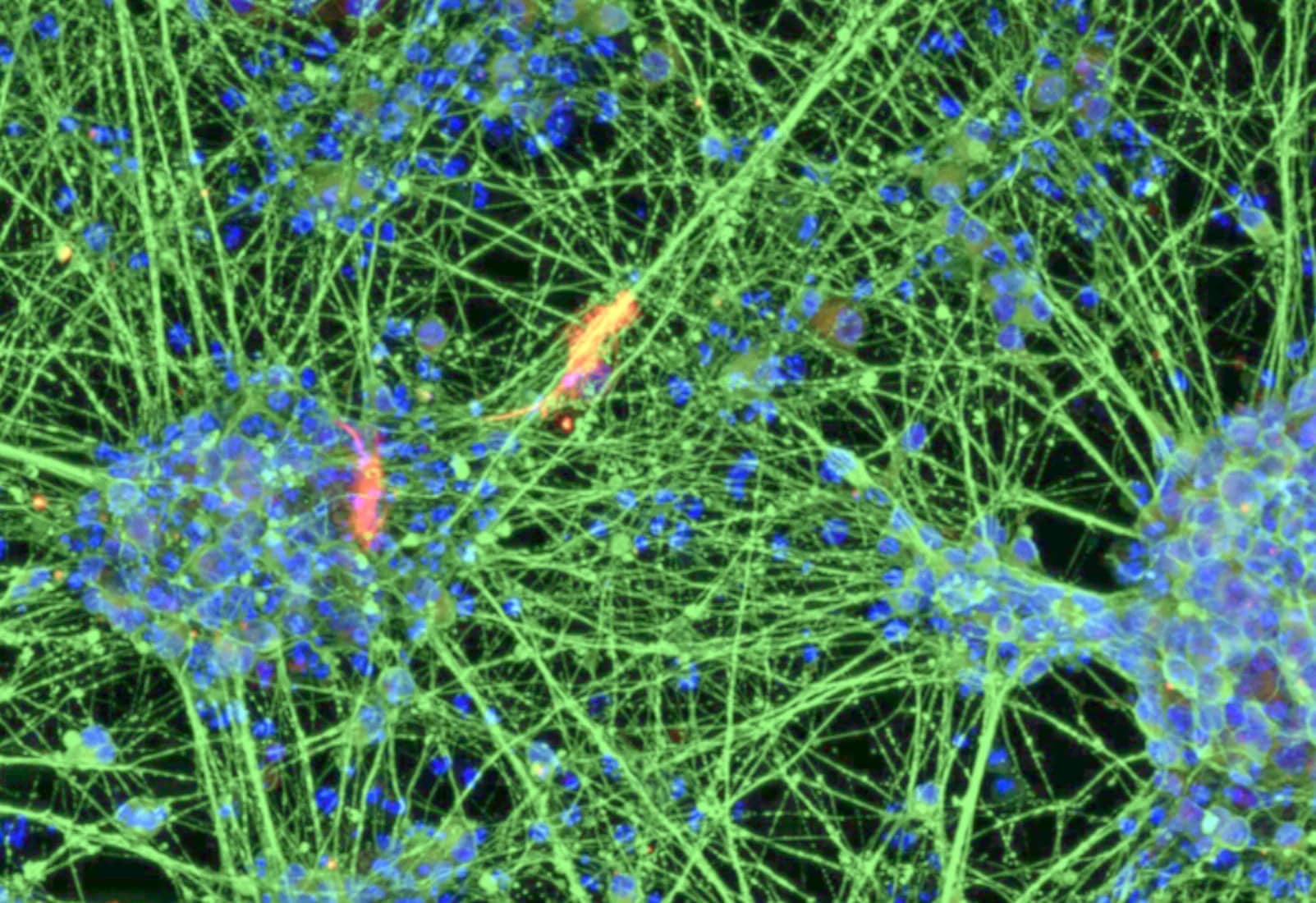 Cellular rejuvenation: A Bonn study on an 80-year-old