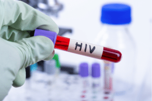 Serbatoi dell'HIV: trovato il lucchetto, ora si cerca la chiave