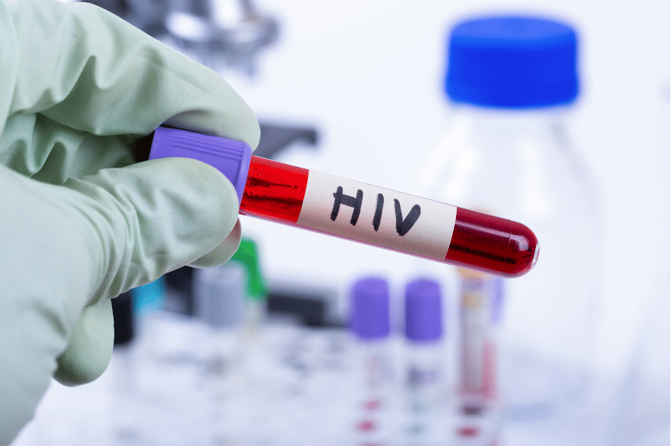 Serbatoi dell'HIV: trovato il lucchetto, ora si cerca la chiave